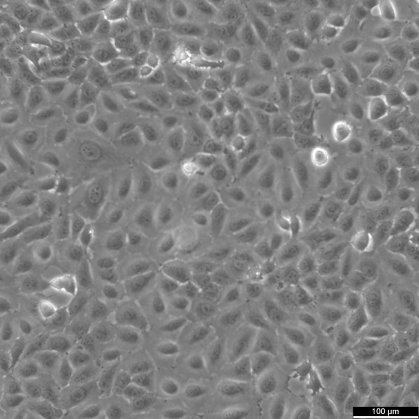 Mahlavu Cells