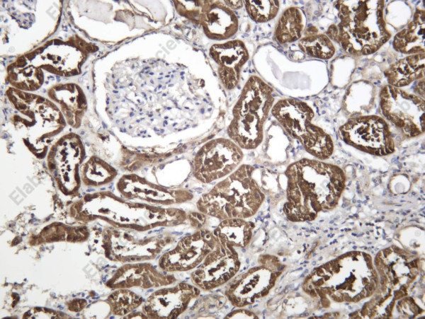 Anti-Recombinant Midkine, clone C112376