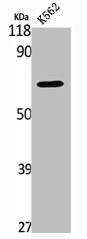 Anti-SNX1