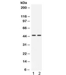 Anti-Cathepsin K