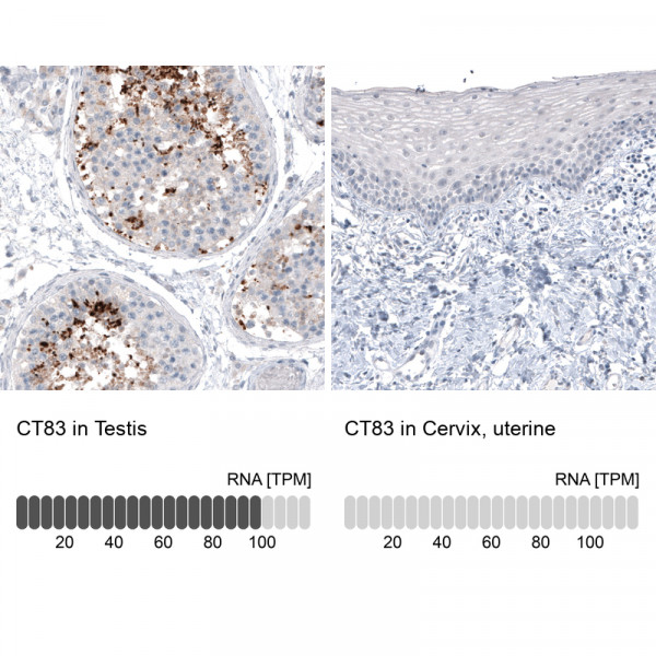 Anti-CT83, clone CL4762