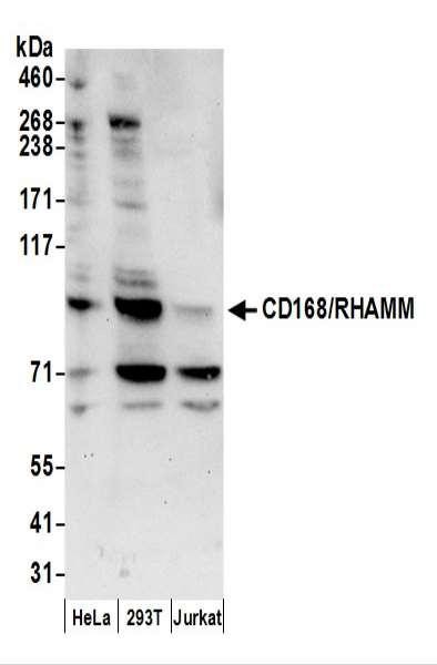 Anti-CD168/RHAMM