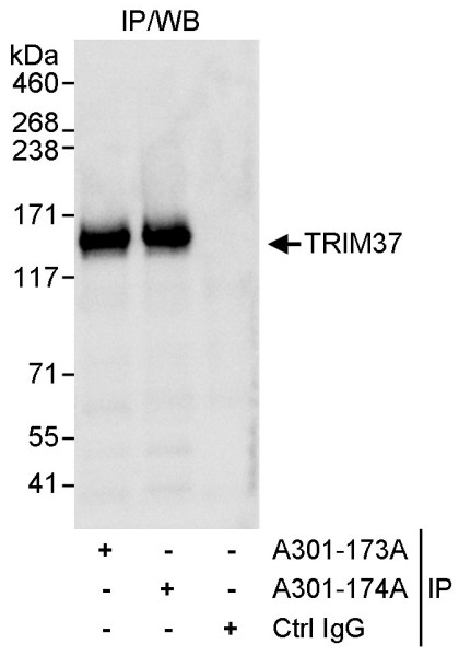 Anti-TRIM37