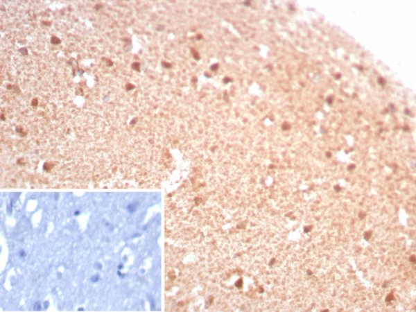 Anti-Creatine Phosphokinase-BB (CK-BB), recombinant antibody, clone rCKBB/8844