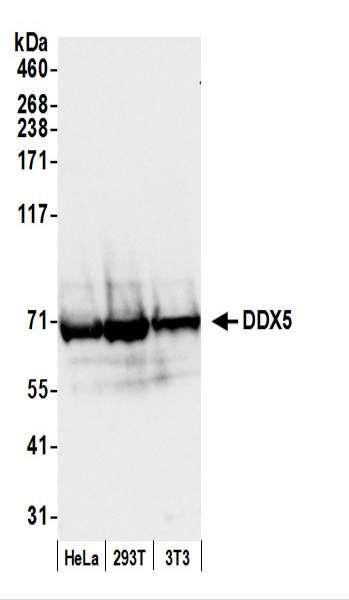 Anti-DDX5