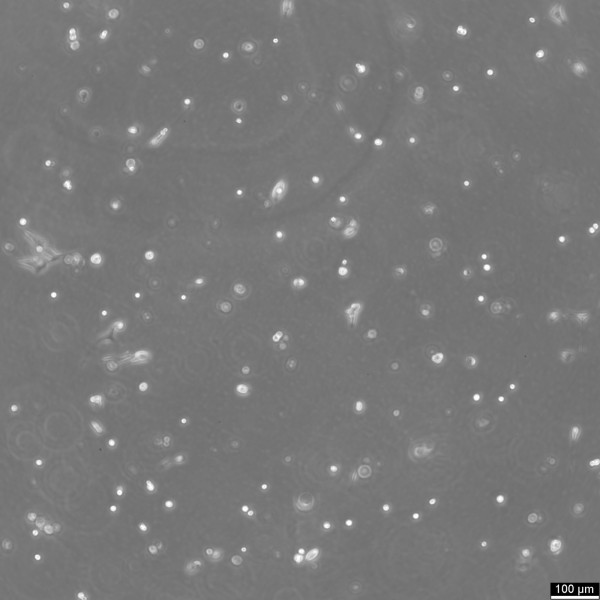 SV-HUC-1 Cells
