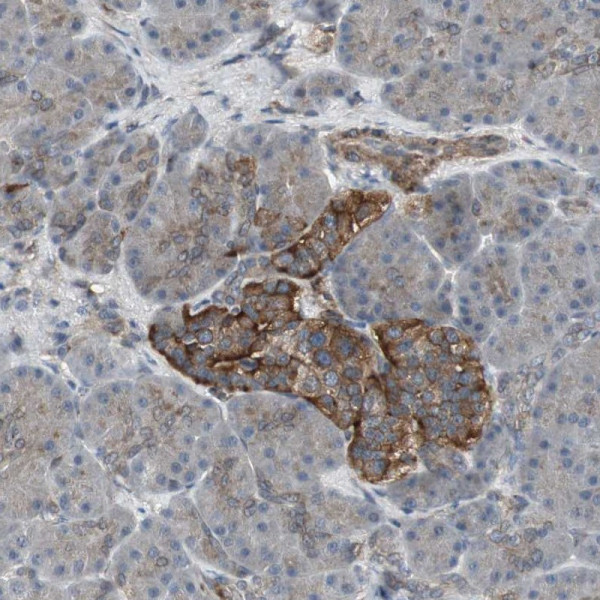 Anti-SCYL3