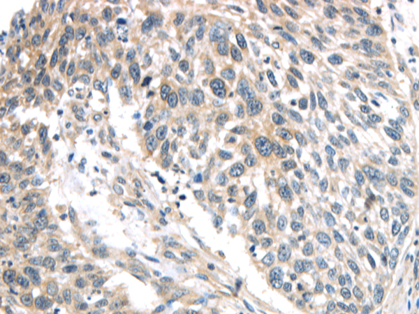 Anti-IQGAP2