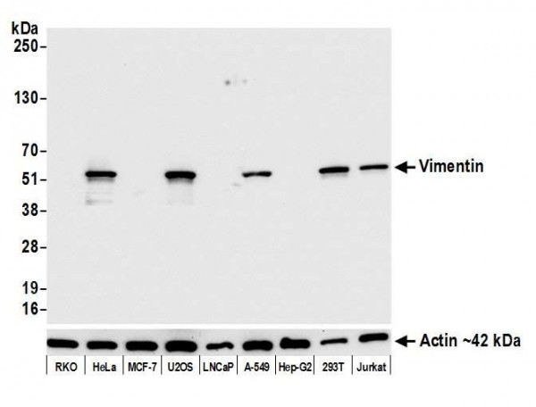 Anti-Vimentin Recombinant Monoclonal