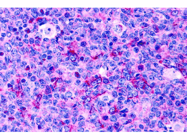 Anti-Caspase-3