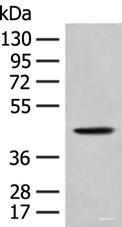 Anti-HLA-B