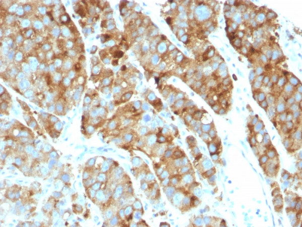 Anti-CD63 (Late Endosomes Marker), clone LAMP3/968