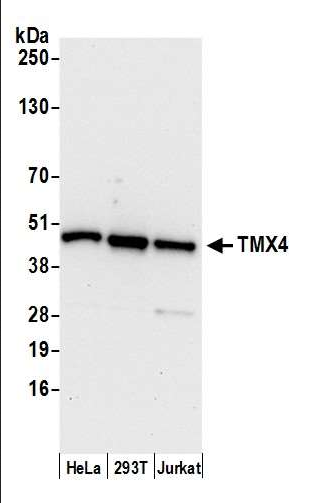 Anti-TMX4