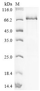 Hydroperoxide isomerase ALOXE3 (ALOXE3), human, recombinant