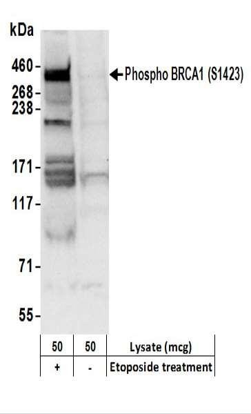 Anti-phospho-BRCA1 (Ser1423)
