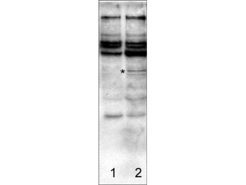 Anti-Caspase-2 (ICH-1, Nedd2)