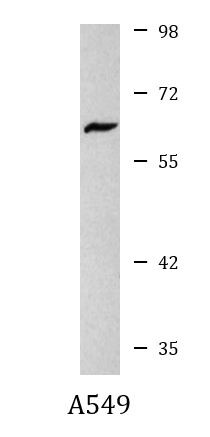 Anti-Cytochrome P450 17A1, clone 6E1-H9-F6
