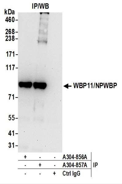 Anti-WBP11/NPWBP