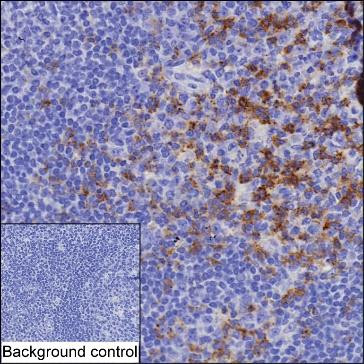 Anti-PDCD1