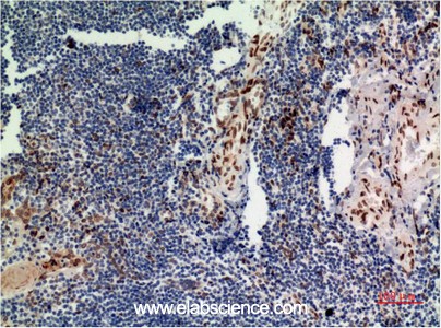 Anti-ERK 1, clone 4G11