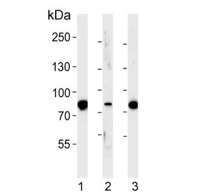 Anti-EHHADH / L-bifunctional protein / LBP