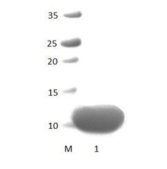 InaDl_9 PDZ Domain