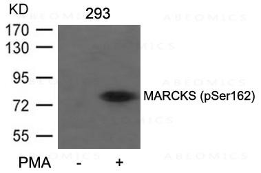 Anti-phospho-MARCKS (Ser162)