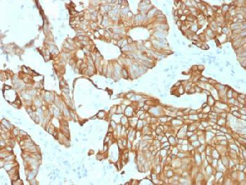 Anti-Cytokeratin 19 (Pancreatic Stem Cell Marker) Recombinant Mouse Monoclonal Antibody (clone:rKRT1
