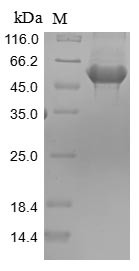 Pyruvate kinase PKM (Pkm), rat, recombinant