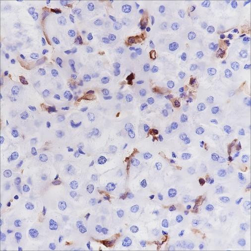 Anti-Recombinant HLA-DRA, clone A251