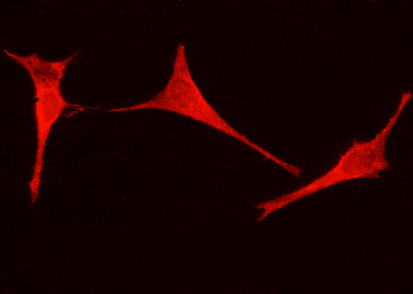 Anti-ENO3/beta-enolase Monoclonal Antibody