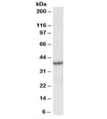 Anti-PCBP1