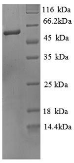 Alkaline phosphatase, tissue-nonspecific isozyme (Alpl),partial, mouse, recombinant