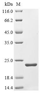 Putative hydrolase RBBP9 (Rbbp9), mouse, recombinant