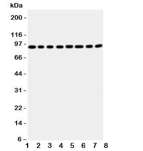 Anti-Factor VIII