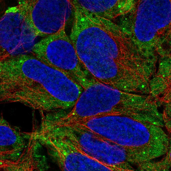 Anti-TNNI3