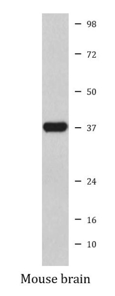 Anti-Otx1