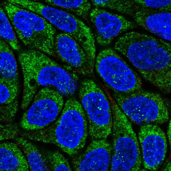 Anti-RSAD2