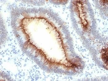 Anti-CEA (Carcinoembryonic Antigen), clone SPM330