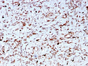 Anti-C1QA / Complement C1q A-Chain, clone C1QA/2956