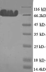 E3 ubiquitin-protein ligase MYLIP (MYLIP), human, recombinant