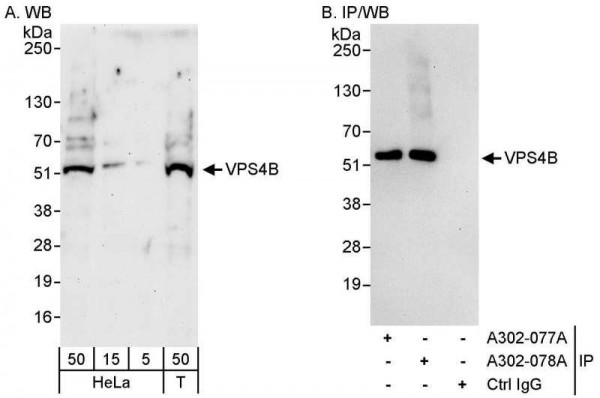 Anti-VPS4B