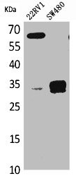 Anti-SFTPA2