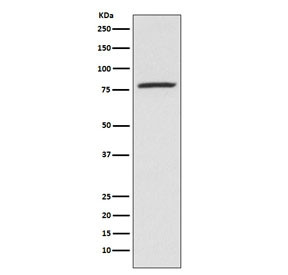 Anti-Arachidonate 5-Lipoxygenase / ALOX5, clone AECE-1