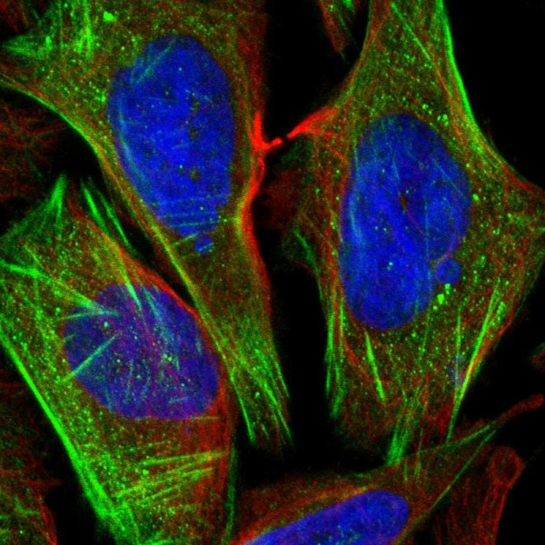 Anti-CSGALNACT1