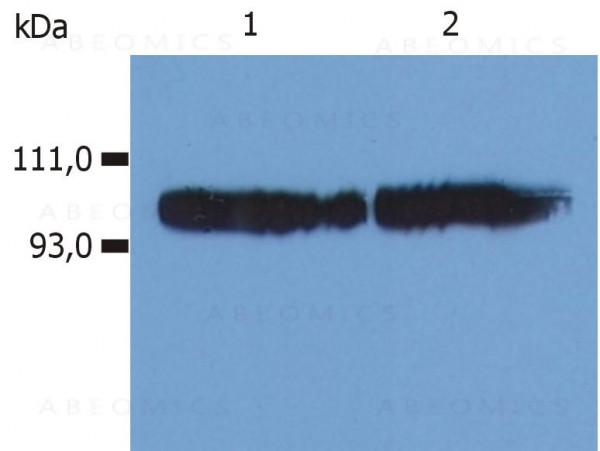 Anti-CD18 / Integrin beta2 subunit Monoclonal Antibody (Clone:MEM-48)-FITC Conjugated