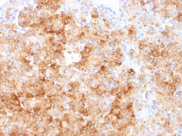 Anti-Chromogranin A / CHGA (Neuroendocrine Marker)