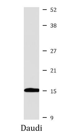 Anti-UBE2N / UBC13