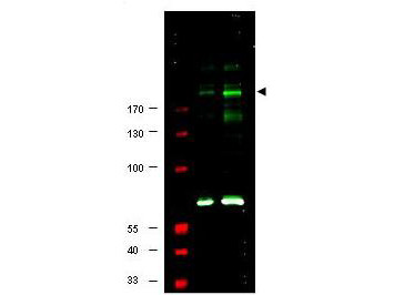 Anti-phospho-IRS-1 (Ser307) (Insulin Receptor Substrate-1)
