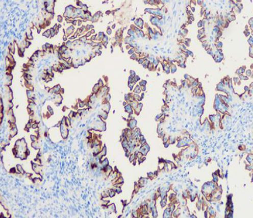 Anti-MUC1 / EMA, clone SQab1891